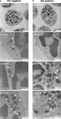 Impact of bronchoalveolar lavage from influenza A virus diseased pigs on neutrophil functions and growth of co-infecting pathogenic bacteria